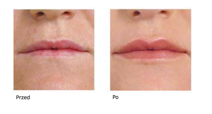 Zaakceptuj siebie z pomocą medycyny estetycznej